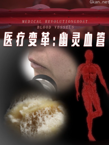 医疗变革：幽灵血管